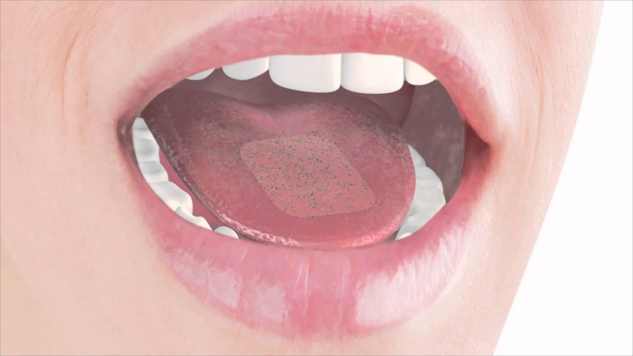 Oral Thin Films Market Size, Share, and Growth Forecast 2025–2033